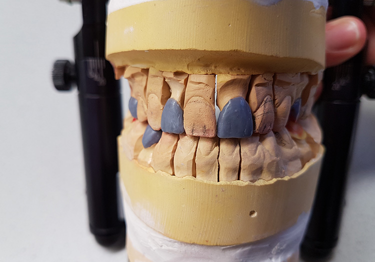 Hofmann Dentaltechnik Azubifortbildungstag 2017 Foto 2