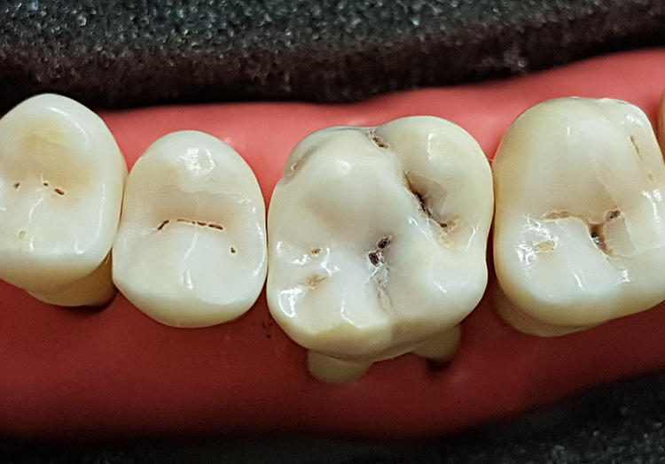 Hofmann Dentaltechnik Azubifortbildungstag 2017 Foto 6