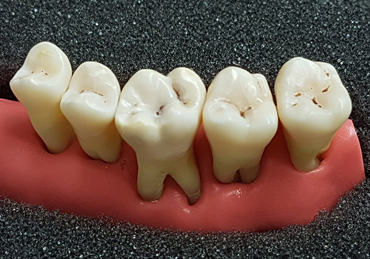 Hofmann Dentaltechnik Azubifortbildungstag 2017 Foto 7