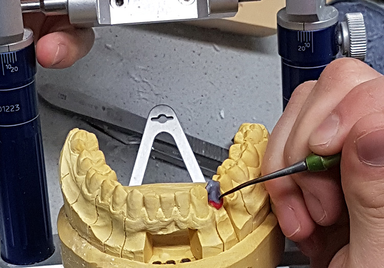 Hofmann Dentaltechnik Azubifortbildungstag 2017 Foto 9